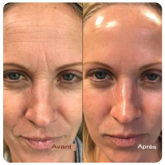 Ampoule liftante au collagène profond et aux peptides de soie-Lift Instantané et Éclat Naturel