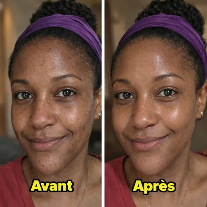 DR.MELAXIN Peel Shot Duo- Ampoule exfoliante au riz noir Shot