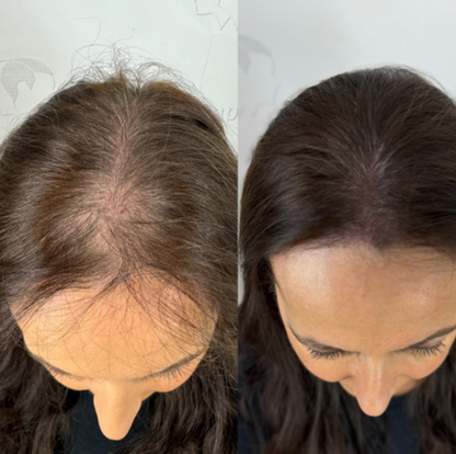 Sérum roll-on pour la croissance des cheveux