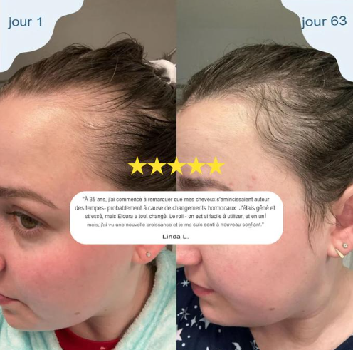 Sérum roll-on pour la croissance des cheveux