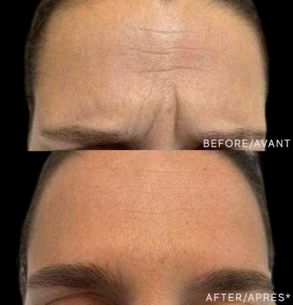 Zooone - Supplément NAD nicotinamide riboside