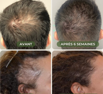 Huile de Batana pour la croissance des cheveux