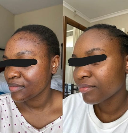 routine soin 5en 1 pour-une-peau-eclatante