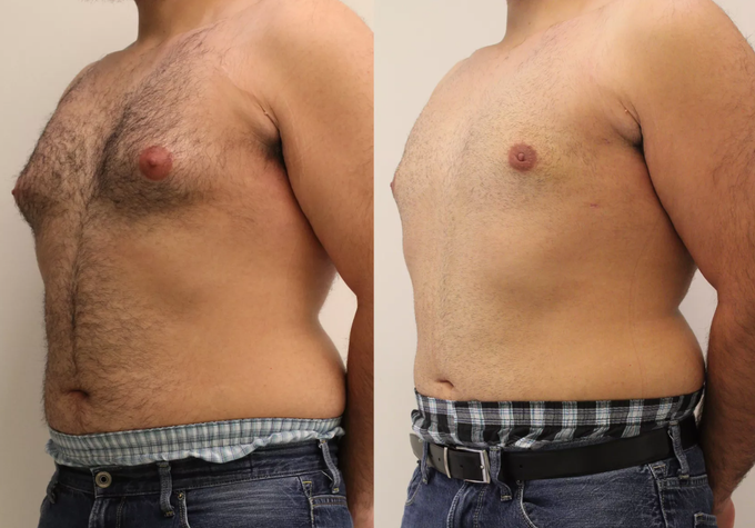 capsules de testostérone turkestérone tongkat ali