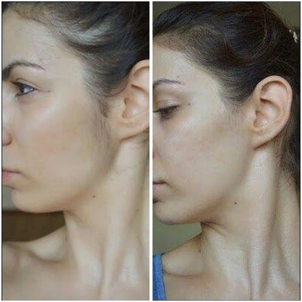 Huile de Cyperus Rotundus -Huile naturelle pour l'épilation et la réduction de la pilosité