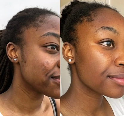 routine soin 5en 1 pour-une-peau-eclatante