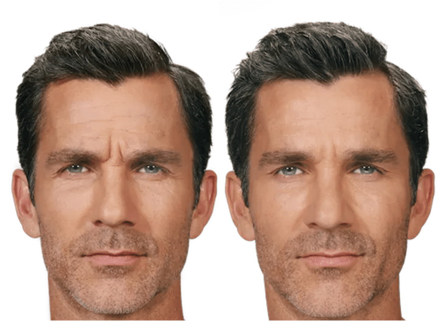 Zooone - Supplément NAD nicotinamide riboside