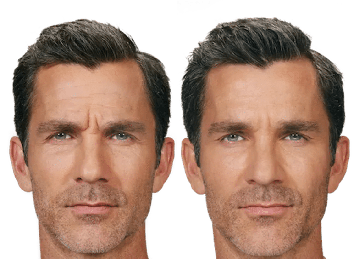 Zooone - Supplément NAD nicotinamide riboside