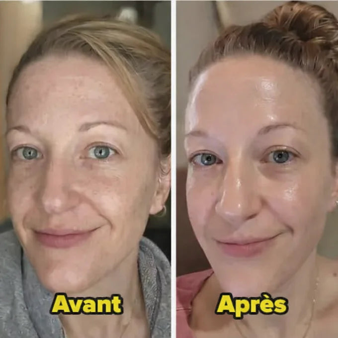 DR.MELAXIN Peel Shot Duo- Ampoule exfoliante au riz noir Shot