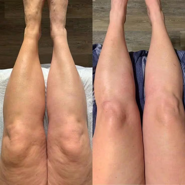Drainage Lymphatique Liquide – Visage Affiné, Jambes Légères, Ventre Plat