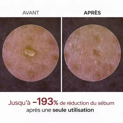 DR.MELAXIN Peel Shot Duo- Ampoule exfoliante au riz noir Shot