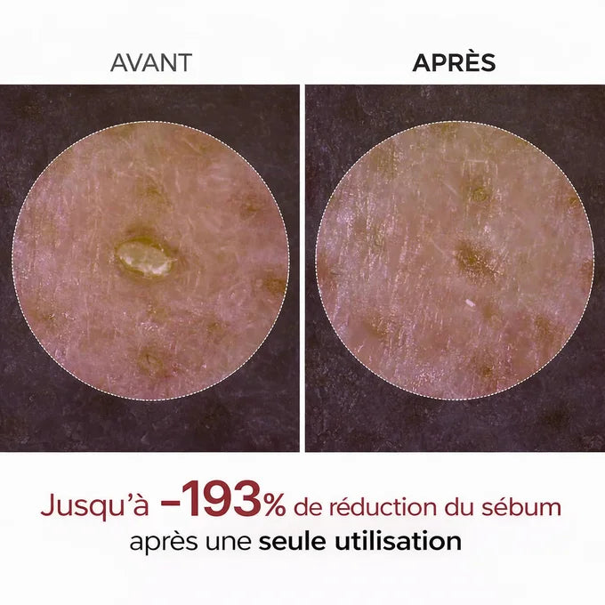 DR.MELAXIN Peel Shot Duo- Ampoule exfoliante au riz noir Shot