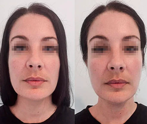 Drainage Lymphatique Liquide – Visage Affiné, Jambes Légères, Ventre Plat